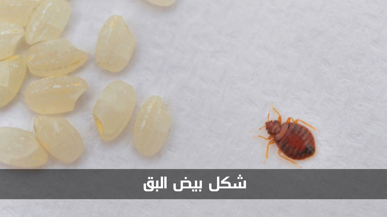 شكل بيض البق بالصور وطريقة التخلص منه بشكل نهائي 5 شكل بيض البق بالصور وطريقة التخلص منه بشكل نهائي