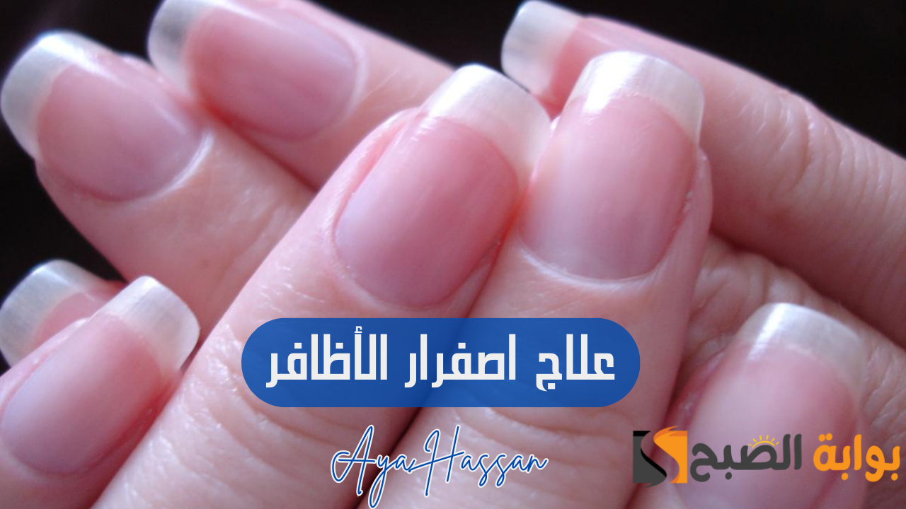 "مشكلتك حلها عندنا".. وصفات للتخلص من اصفرار الاظافر بشكل نهائي 5 “مشكلتك حلها عندنا”.. وصفات للتخلص من اصفرار الاظافر بشكل نهائي