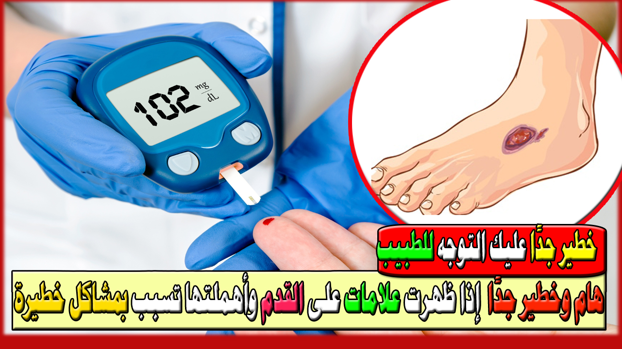 خطير جدًا عليك التوجه للطبيب بأسرع ما يمكن إذا ظهرت علامات على القدم وأهملتها تسبب بمشاكل خطيرة بالصور 5 خطير جدًا عليك التوجه للطبيب بأسرع ما يمكن إذا ظهرت علامات على القدم وأهملتها تسبب بمشاكل خطيرة بالصور