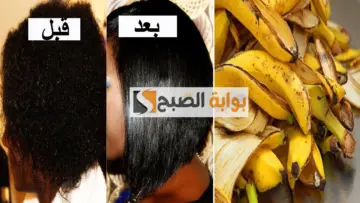 وصفة بمليون جنيه.. قناع قشر الموز للشعر هيخلي شعرك أجمل من شعر الهنود وصفة عطار عجوز