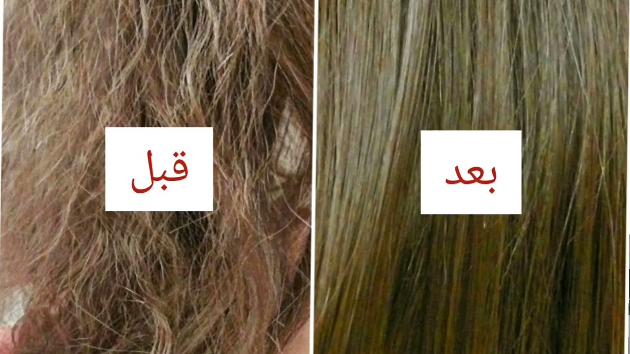 وصفات طبيعية لعلاج هيشان الشعر بأقل تكلفة 5 وصفات طبيعية لعلاج هيشان الشعر بأقل تكلفة