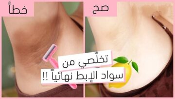 فعالة من أول استخدام.. وصفة لتفتيح تحت الابط بكفاءة عالية وبمكونات طبيعية موجودة في منزلك