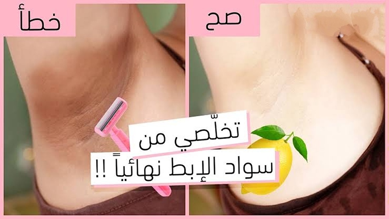 فعالة من أول استخدام.. وصفة لتفتيح تحت الابط بكفاءة عالية وبمكونات طبيعية موجودة في منزلك 5 فعالة من أول استخدام.. وصفة لتفتيح تحت الابط بكفاءة عالية وبمكونات طبيعية موجودة في منزلك