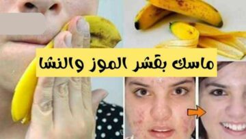 النتيجة تستحق.. طريقة عمل ماسك قشر الموز والنشا لتفتيح البشرة أكثر من درجة خطوة بخطوة في البيت