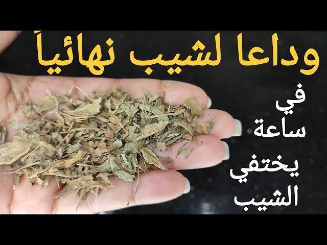 مش هتروحي للكوافير.. التخلص من شيب الشعر وتلوين طبيعي في ساعه واحده هتلاحظي الفرق 5 مش هتروحي للكوافير.. التخلص من شيب الشعر وتلوين طبيعي في ساعه واحده هتلاحظي الفرق