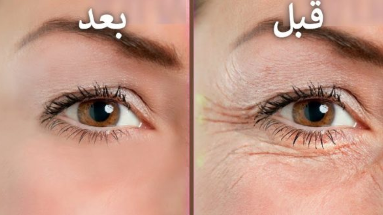 أفضل وصفة للتجاعيد والخطوط الرفيعة هترجعلك شبابك تاني بأقل تكلفة 5 أفضل وصفة للتجاعيد والخطوط الرفيعة هترجعلك شبابك تاني بأقل تكلفة
