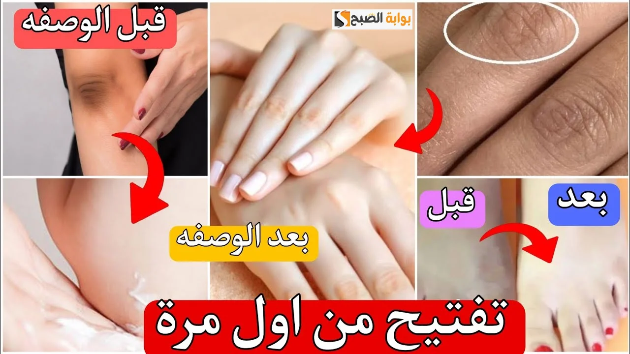 خلي ايدك بملمس الأطفال.. ماسكات طبيعية لتبيض اليدين والقدمين وإزالة التشققات نهائيا من اول استعمال 5 خلي ايدك بملمس الأطفال.. ماسكات طبيعية لتبيض اليدين والقدمين وإزالة التشققات نهائيا من اول استعمال