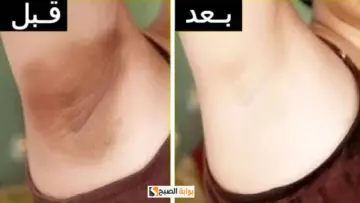 “هتلاحظي الفرق” وصفة تفتيح المناطق الحساسة في أقل وقت وطريقة الاستخدام