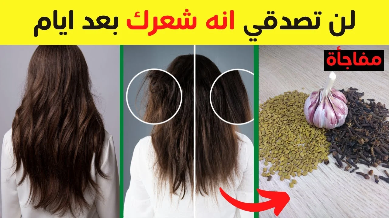 الكل هيسالك عليه.. وصفات جبارة لتطويل وتكثيف الشعر وابنات الفراغات جربية بنفسك وهتدعيلى 5 الكل هيسالك عليه.. وصفات جبارة لتطويل وتكثيف الشعر وابنات الفراغات جربية بنفسك وهتدعيلى