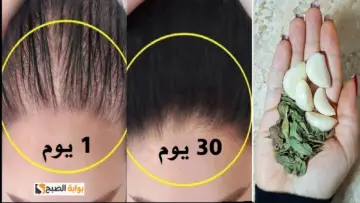 بطريقة طبيعية وأمنة.. وصفة منزلية لإنبات فراغات الشعر ومقدمة الرأس بسرعة الصاروخ