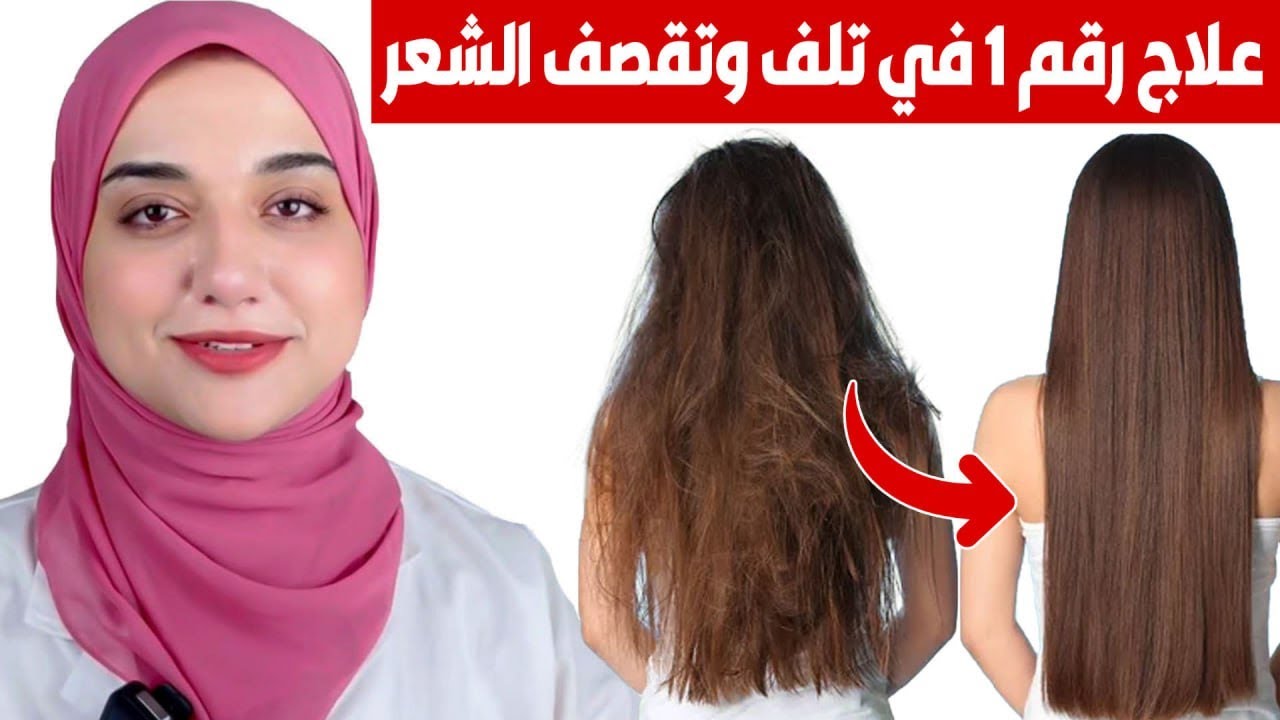 اتخلصي من جفاف الشعر نهائيًا.. طريقة ماسكات الألوفيرا لإطلاله ساحرة وشعر صحي 5 اتخلصي من جفاف الشعر نهائيًا.. طريقة ماسكات الألوفيرا لإطلاله ساحرة وشعر صحي