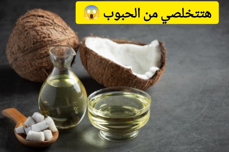 هتتخلصي منها تمامًا.. طريقة عمل ماسك الخميرة مع جوز الهند للتخلص من الحبوب 5 هتتخلصي منها تمامًا.. طريقة عمل ماسك الخميرة مع جوز الهند للتخلص من الحبوب