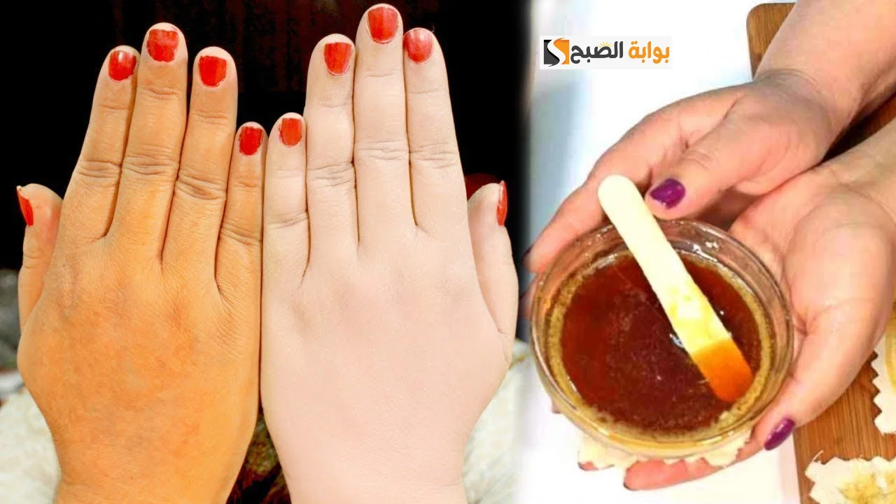 خلطة فورية من مطبخك تعمل على تبييض القدمين وإزالة الجلد الميت في يومين فقط!! 5 خلطة فورية من مطبخك تعمل على تبييض القدمين وإزالة الجلد الميت في يومين فقط!!