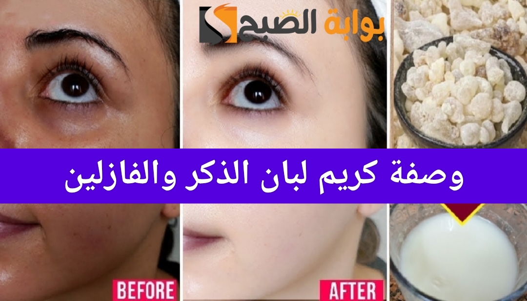طريقة تحضير وصفة كريم لبان الذكر والفازلين لتفتيح البشرة