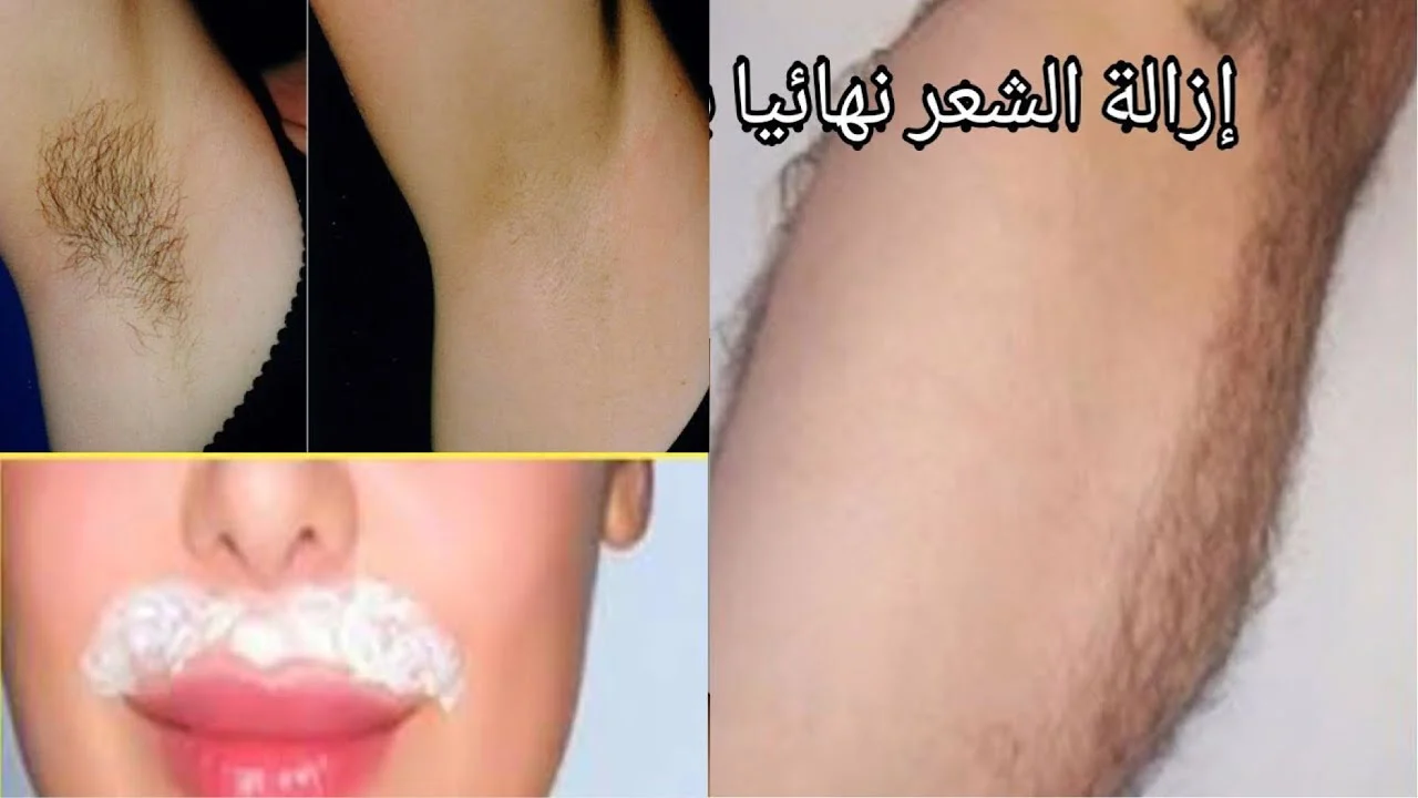 اقوي من الليزر.. ازاله شعر الجسم بالكامل وتبييض دائم بافضل وصفة طبيعية منزلية بدون مواد ضاره