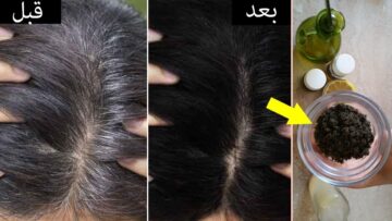 التخلص من الشعر الابيض بوصفات طبيعية والنتيجة فورية