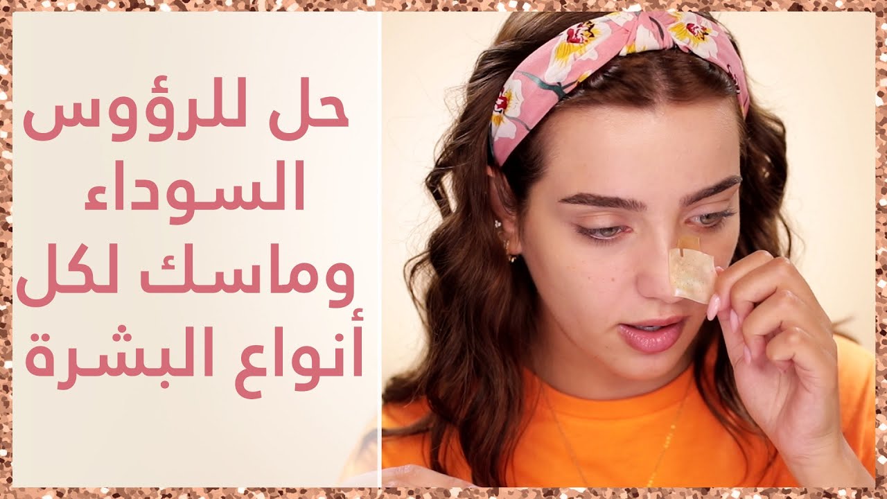 وصفات طبيعية للرؤوس السوداء وتفتيح البشرة هتتخلصي منها بكل سهولة وبمواد طبيعية وآمنة