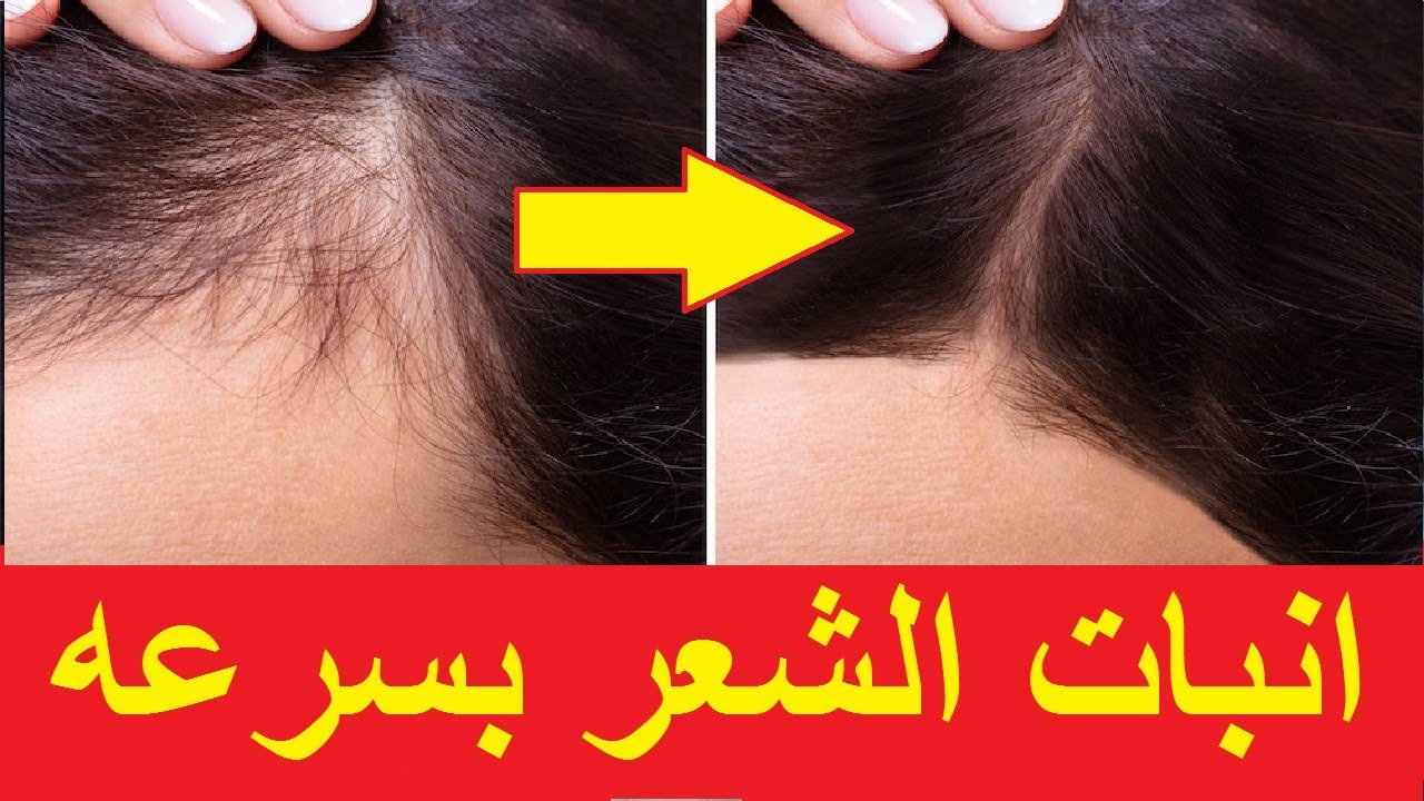 وصفات طبيعية غير مكلفة لتكثيف الشعر هيبقى ثقيل وناعم ومفيش توكة تكفيه