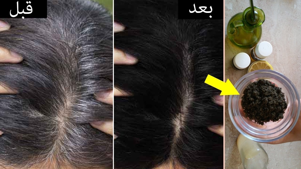 وصفة طبيعية لإخفاء الشعر الأبيض بلون صحي.. والتخلص من الشيب نهائياً