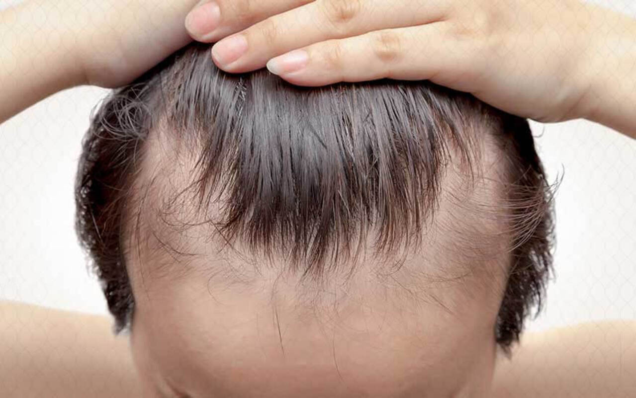 طرق علاج ضعف الشعر طبيعيًا والتخلص من جميع المشاكل!!