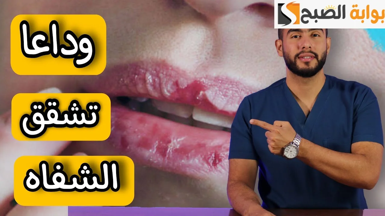من غير فلوس كتير ولا  جلسات تقشير” أسهل طريقة للتخلص من تشقق الشفايف بأقل تكلفة ممكنة!