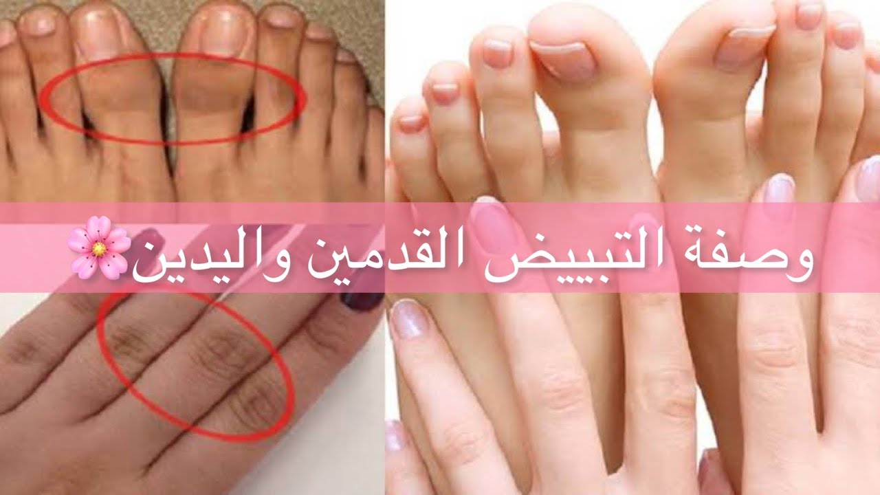 وصفة مغربية لتفتيح اليدين والقدمين بنتائج مذهلة هتخلىي ايديك زي الأطفال