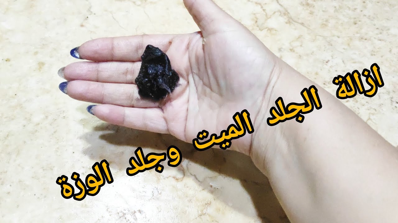 مش هتشوفيه تاني .. وصفة خرافيه في المنزل لإزالة الجلد الميت