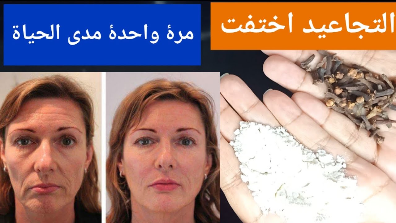 هتبقى منورة دائما.. وصفة القرنفل والنشا لتفتيح البشرة والجسم كله وإزالة البقع والتصبغات والتجاعيد من اول استعمال