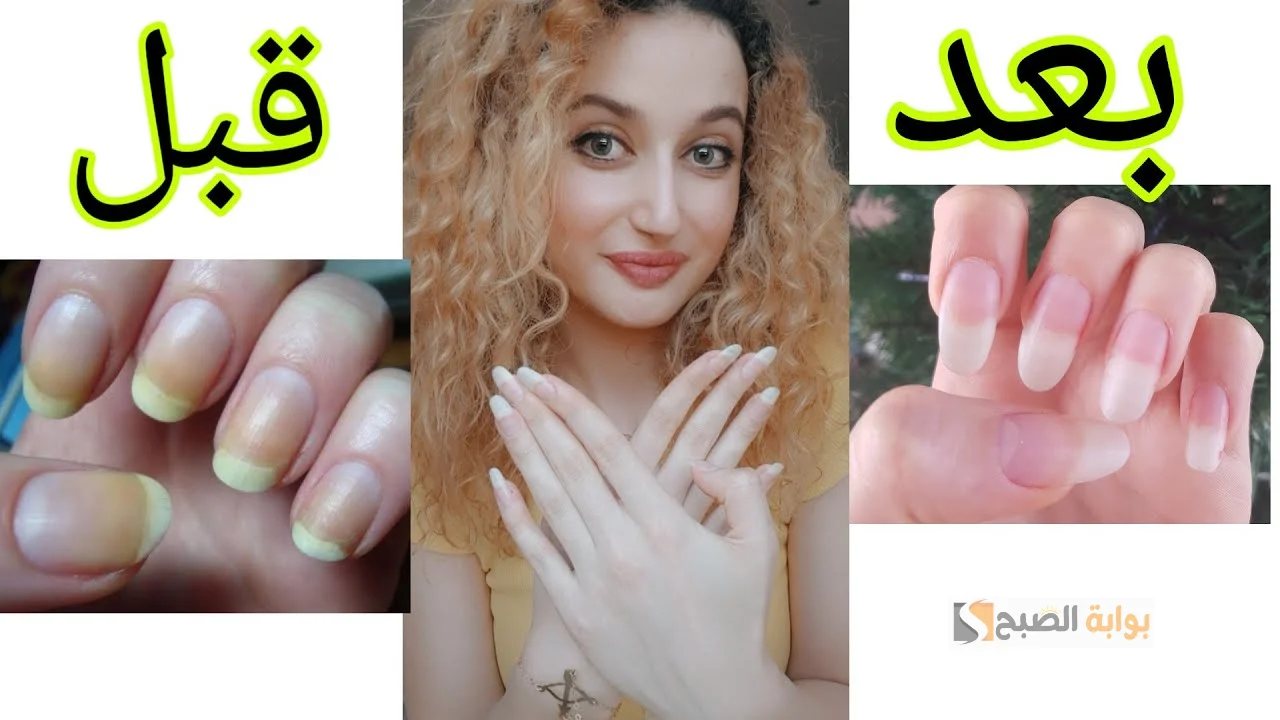 عشان ما تحسيش بالإحراج تاني .. وصفات طبيعية لتبييض الأظافر من مكونات سهلة فى بيتك.. معجون الأسنان أبرزها