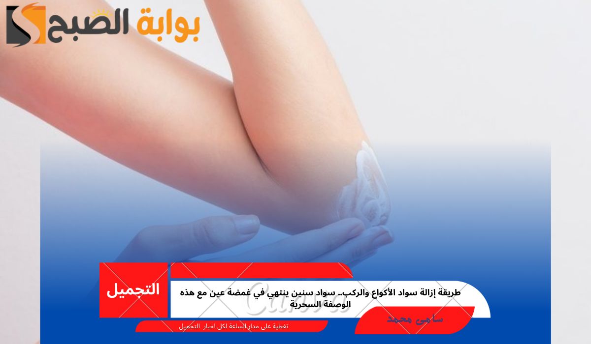طريقة إزالة سواد الأكواع والركب.. سواد سنين ينتهي في غمضة عين مع هذه الوصفة السحرية