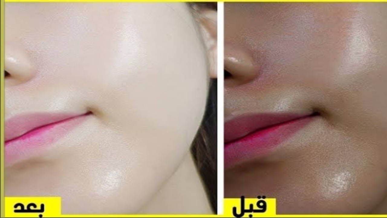 زيت الخروع لإزالة التصبغات والنمش وتفتيح البشرة