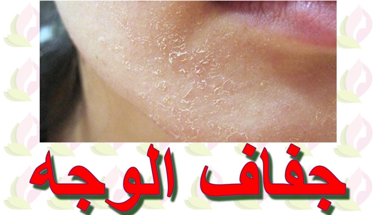 وصفات طبيعية للتخلص من جفاف البشرة من أول استخدام