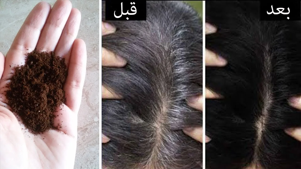 جربيها فورًا.. وصفات للتخلص من الشعر الأبيض في المنزل بمكونات طبيعية واقتصادية