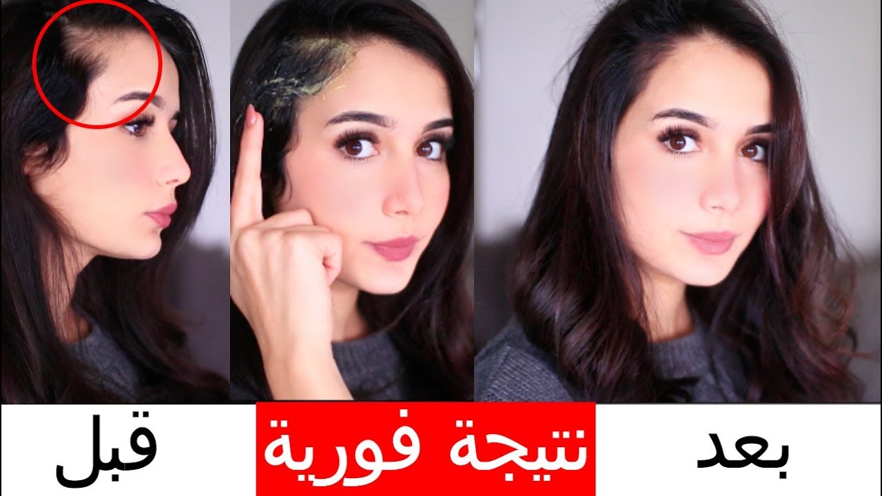 تكثيف الشعر وتطويله بوصفات الجدات تراث طبيعي لصحة الشعر
