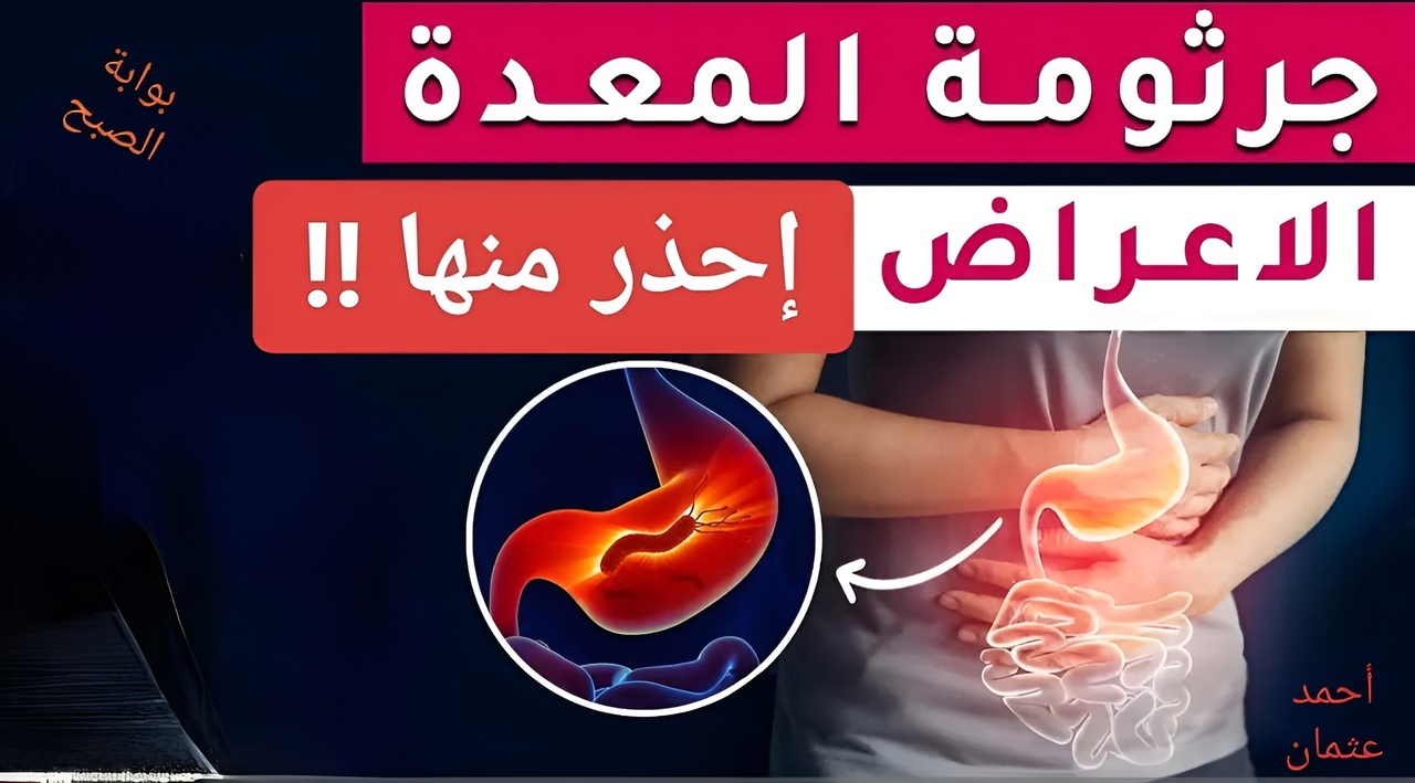 “إحذر منها !!”.. علامات الإصابة بجرثومة المعدة لا تتجاهلها قبل فوات الآوان ومتى يجب عليك إستشارة الطبيب ؟