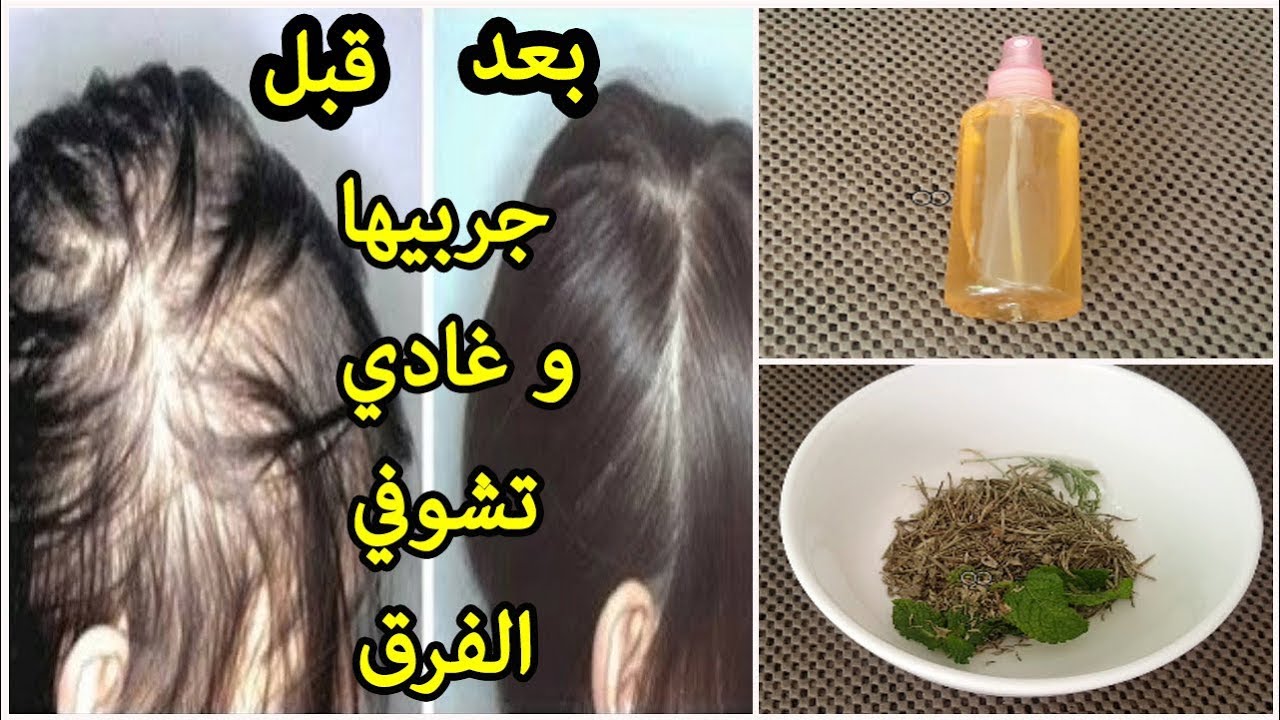 هيطول بجنون.. مكون ضعيه على القهوة لتطويل الشعر وتكثيفه بأسرع وقت
