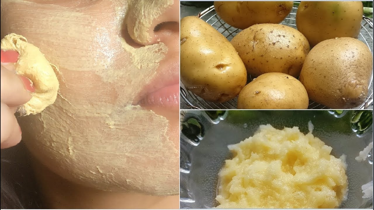 كنز في بيتك.. قشر البطاطس من انهارده مش هترميه تاني شوفي هتعملي بيه ايه